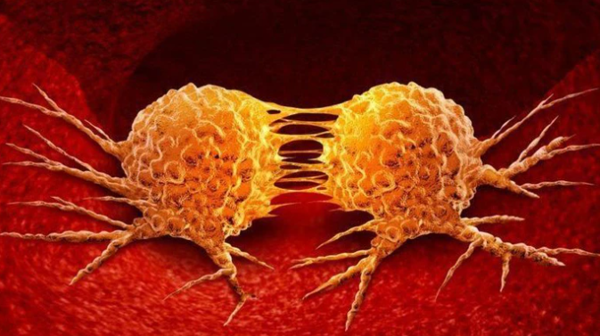 Khối u ác tính có thể gây tử vong cho người bệnh